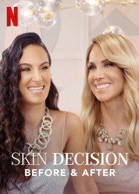 Lựa chọn lột xác: Trước và sau | Skin Decision: Before and After (2020) Lựa chọn lột xác: Trước và sau | Skin Decision: Before and After (2020)